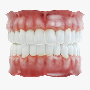 Dentures