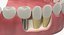 3D dental 5