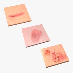 Skin Surfaces Collection