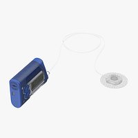 Insulin Pump