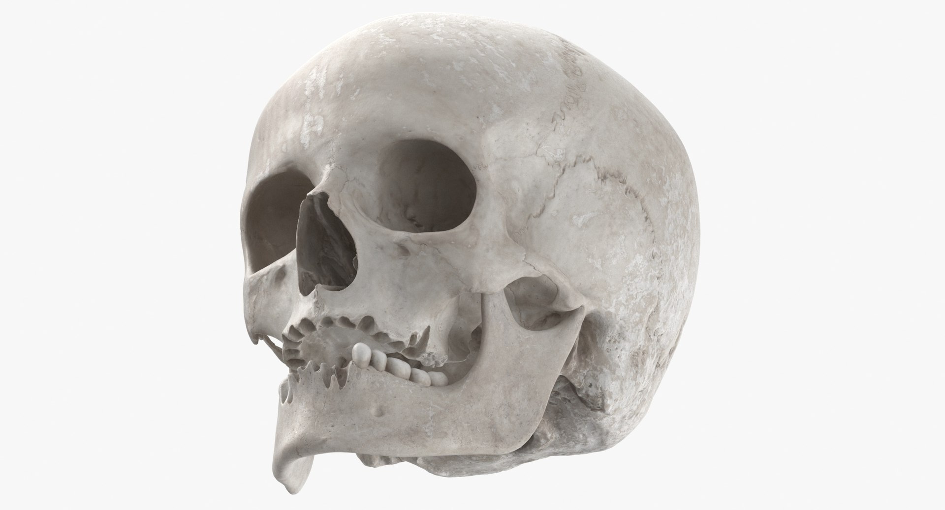 Human Skulls Collection 02 White and Yellow - 24 models 3D https://p.turbosquid.com/ts-thumb/Jg/W3abjh/Gq/human_female_skull_with_jaw_damaged_02_white_thumbnail_0008/jpg/1623668870/1920x1080/fit_q87/042f3333be8e4ad11d7d9aff2ffc113f89d2fbdc/human_female_skull_with_jaw_damaged_02_white_thumbnail_0008.jpg