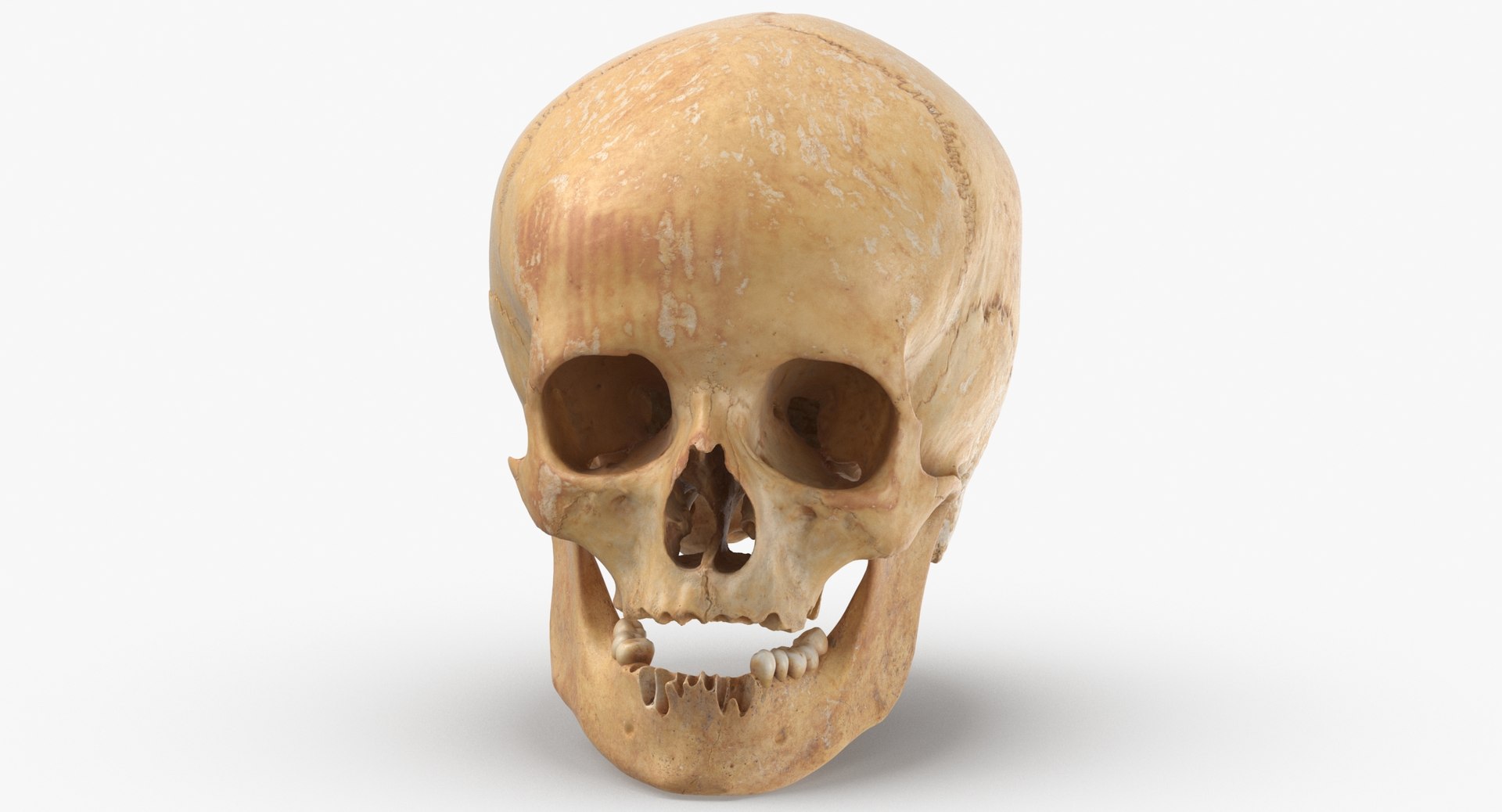Human Skulls Collection 02 White and Yellow - 24 models 3D https://p.turbosquid.com/ts-thumb/Jg/W3abjh/M4/human_female_skull_damaged_02_thumbnail_0004/jpg/1623668911/1920x1080/fit_q87/1f6fc898908fbc0615343f2fb715235f2bba7db5/human_female_skull_damaged_02_thumbnail_0004.jpg
