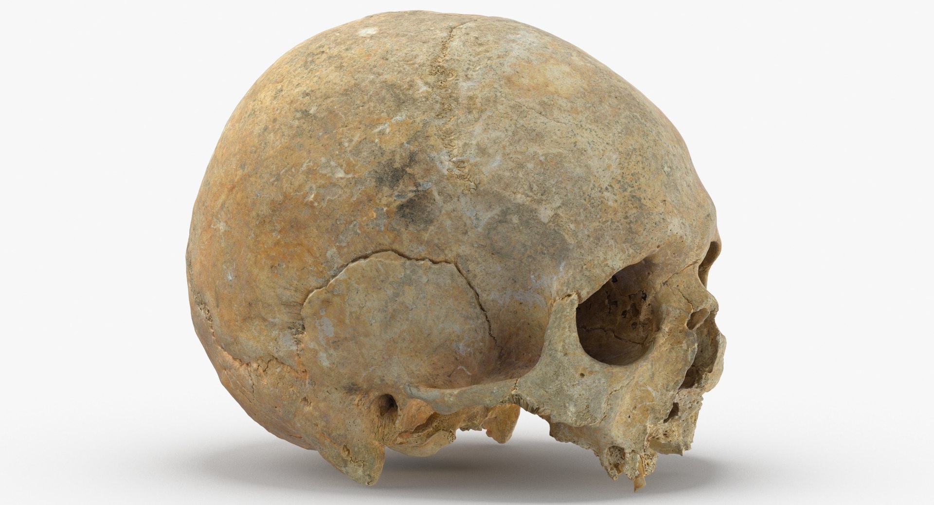 Human Skulls Collection 02 White and Yellow - 24 models 3D https://p.turbosquid.com/ts-thumb/Jg/W3abjh/gc/human_skull_cranium_with_leprosy_01_thumbnail_0003/jpg/1623668910/1920x1080/fit_q87/bd2e6399ccee66a3ed13e7f9ecc4e76de5018576/human_skull_cranium_with_leprosy_01_thumbnail_0003.jpg