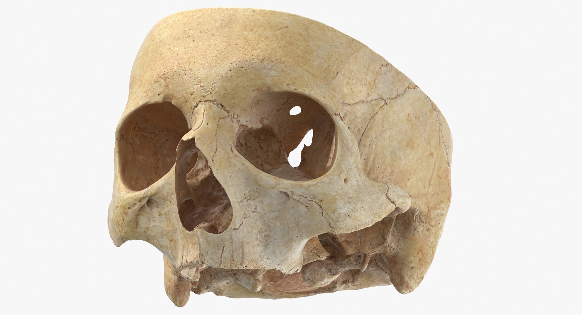 Human Skulls Collection 02 White and Yellow - 24 models 3D https://p.turbosquid.com/ts-thumb/Jg/W3abjh/hD/human_skull_cranial_02_cut_thumbnail_0008/jpg/1623668891/1920x1080/fit_q87/580cd99ed1524c7f4b297efff563a007f9742724/human_skull_cranial_02_cut_thumbnail_0008.jpg
