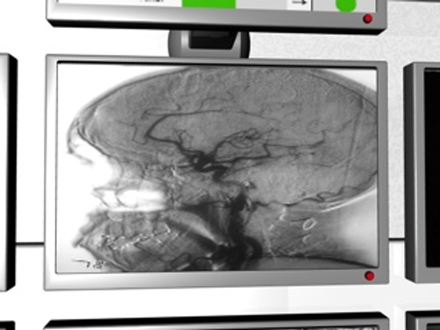 c4d medical monitors https://p.turbosquid.com/ts-thumb/Jl/QNQCfW/2pb8wYXC/medicaldisplayscreenshot9/jpg/1212680173/1920x1080/fit_q87/4bb609bb888c9ada3461f8bdc23de213a4aff045/medicaldisplayscreenshot9.jpg