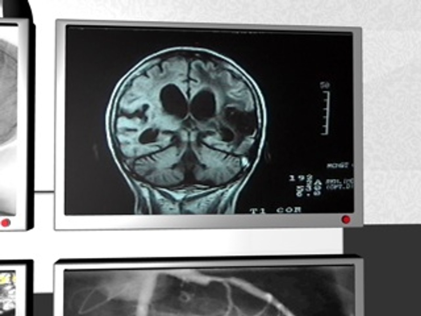 c4d medical monitors https://p.turbosquid.com/ts-thumb/Jl/QNQCfW/OVRmMgIN/medicaldisplayscreenshot10/jpg/1212680154/1920x1080/fit_q87/98c7dd3a1776248c3711d1c03d505b3120c8a677/medicaldisplayscreenshot10.jpg