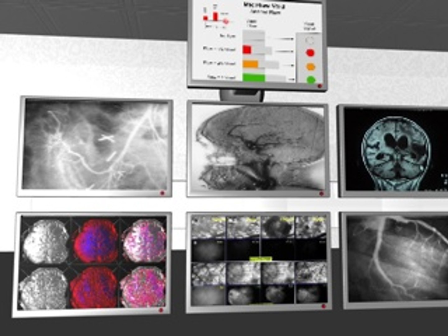 c4d medical monitors https://p.turbosquid.com/ts-thumb/Jl/QNQCfW/vpP44xfg/medicaldisplayscreenshot7/jpg/1212680165/1920x1080/fit_q87/b09d17426380a5dbe1b538d4342add20196fa153/medicaldisplayscreenshot7.jpg