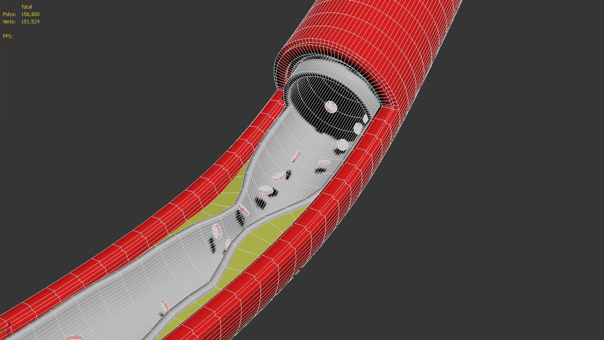 3D Artery Vein Clog https://p.turbosquid.com/ts-thumb/Jo/DmtAqr/0G/156800151524/jpg/1655722746/1920x1080/fit_q87/b85f5dbb1c794da8ca2fbf0cfe9ffddf31c28fa4/156800151524.jpg