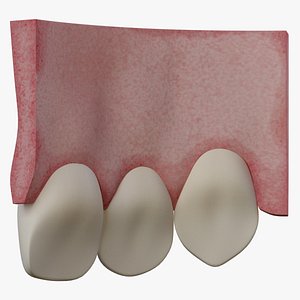 3D jaw central incisor model