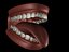 Dentes