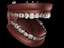 Dentes