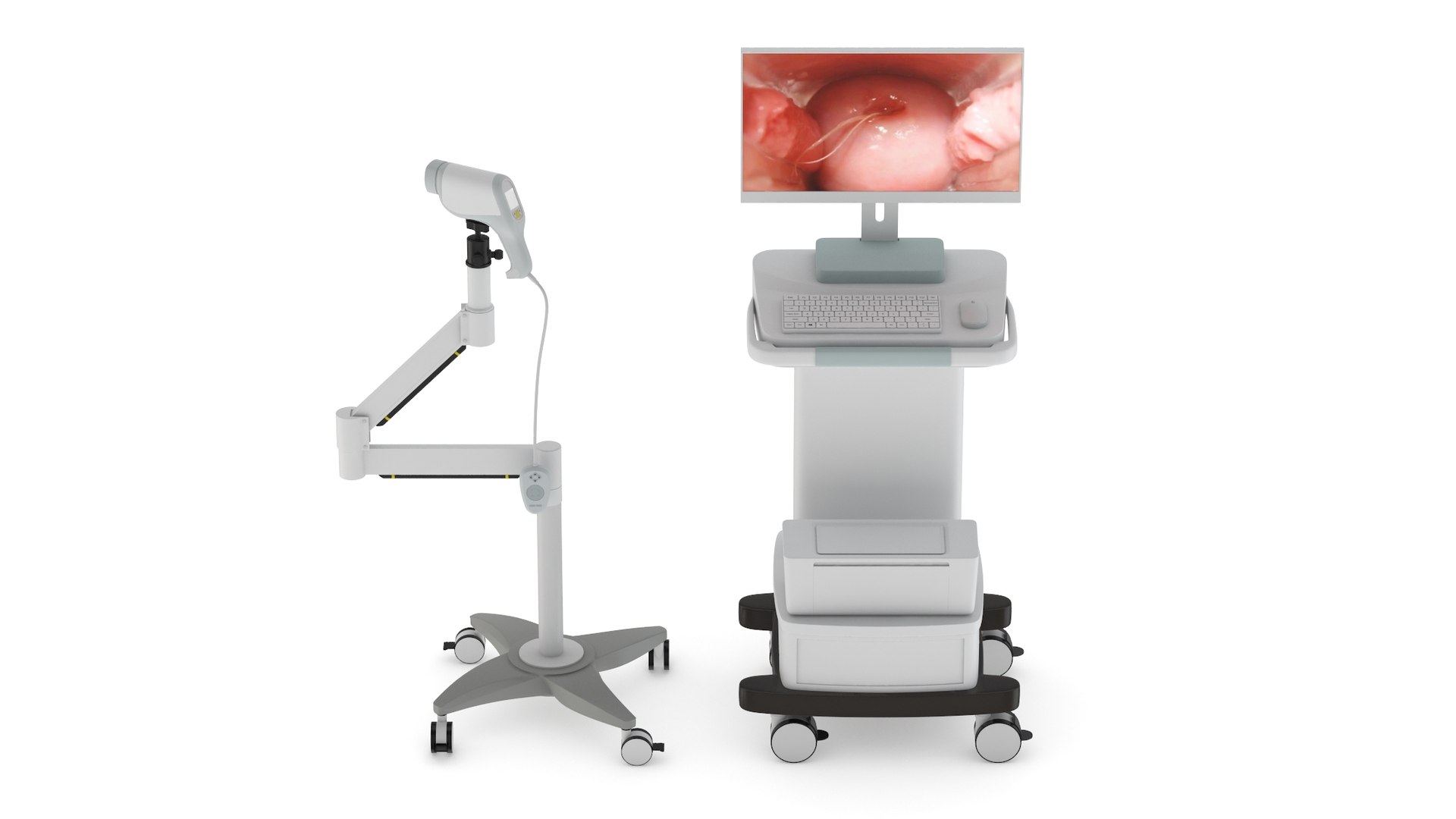 3D 36 Models Medical Treatment Equipment model https://p.turbosquid.com/ts-thumb/Jr/ilzeyU/kQ/medicalcolposcopes_001/jpg/1743740931/1920x1080/fit_q87/d2e13ac131ba01444323f9c98132a6f4786fd266/medicalcolposcopes_001.jpg