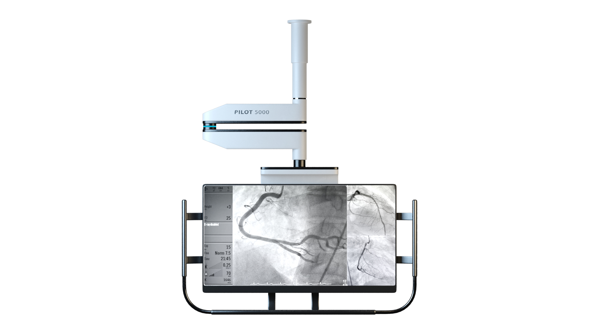 3D Angiography Imagine Monitor Model - TurboSquid 2269780