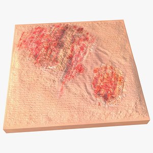 Grazed Skin