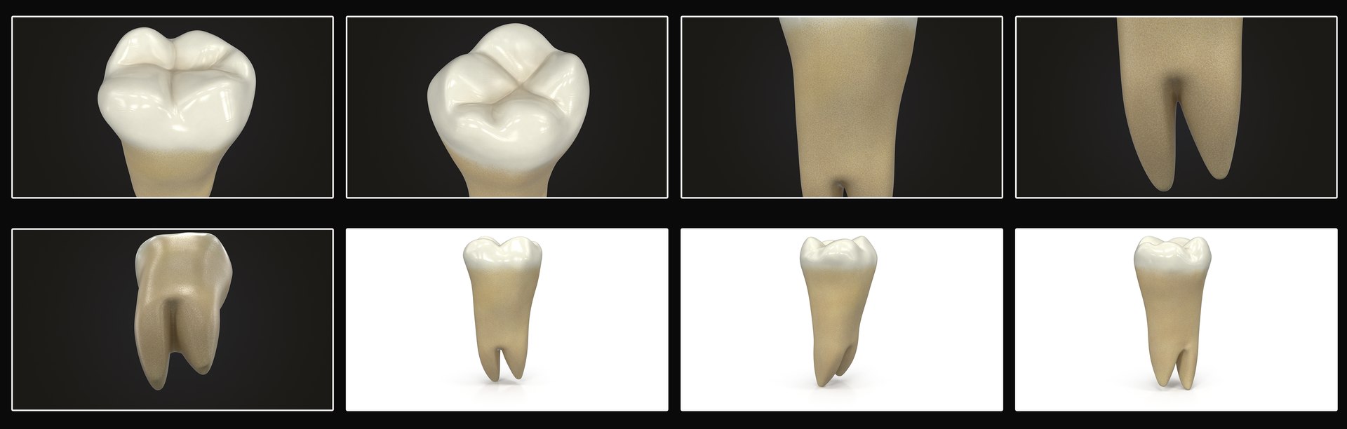 3D upper human teeth https://p.turbosquid.com/ts-thumb/KD/fJCaaP/5t3WK5Hj/lowerthirdmolarwisdom_color/jpg/1599496151/1920x1080/fit_q87/6d3794100242adf8dcbb5a95d23df91e1dd47133/lowerthirdmolarwisdom_color.jpg