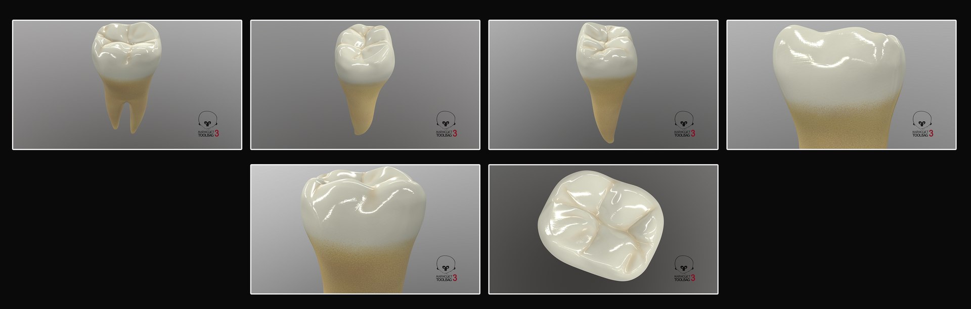3D upper human teeth https://p.turbosquid.com/ts-thumb/KD/fJCaaP/7Rt7riR4/lowersecondmolar_pbr/jpg/1599495548/1920x1080/fit_q87/b2db9012a1885a54e659dd95fa2769d2b1de76dd/lowersecondmolar_pbr.jpg