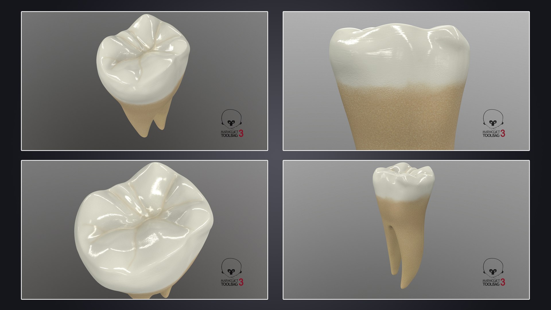 3D upper human teeth https://p.turbosquid.com/ts-thumb/KD/fJCaaP/NAIIAvxk/lowerfirstmolar_pbr/jpg/1599494783/1920x1080/fit_q87/5804396a59a30e5d56b0ee83139cd40b5ba6ca51/lowerfirstmolar_pbr.jpg