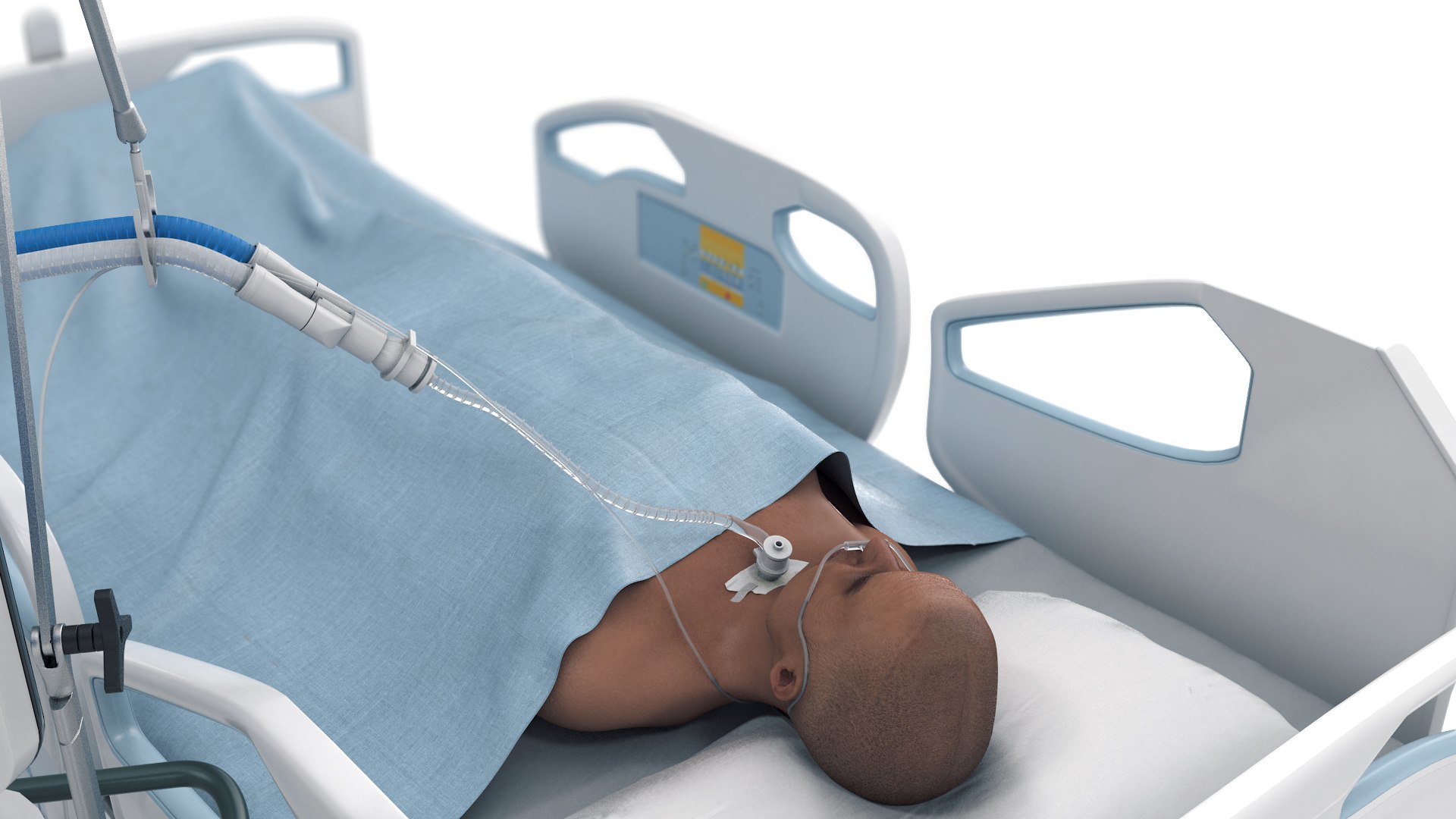 Patient on Ventilator 3D https://p.turbosquid.com/ts-thumb/KR/4O8CGw/45/ponventprev3b/jpg/1692637841/1920x1080/fit_q87/a7c3f35379e96cb741218fe3aa3317f88ebd3729/ponventprev3b.jpg