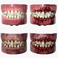 Lowpoly Gums Teeth and Tongue Rotten and Bloody