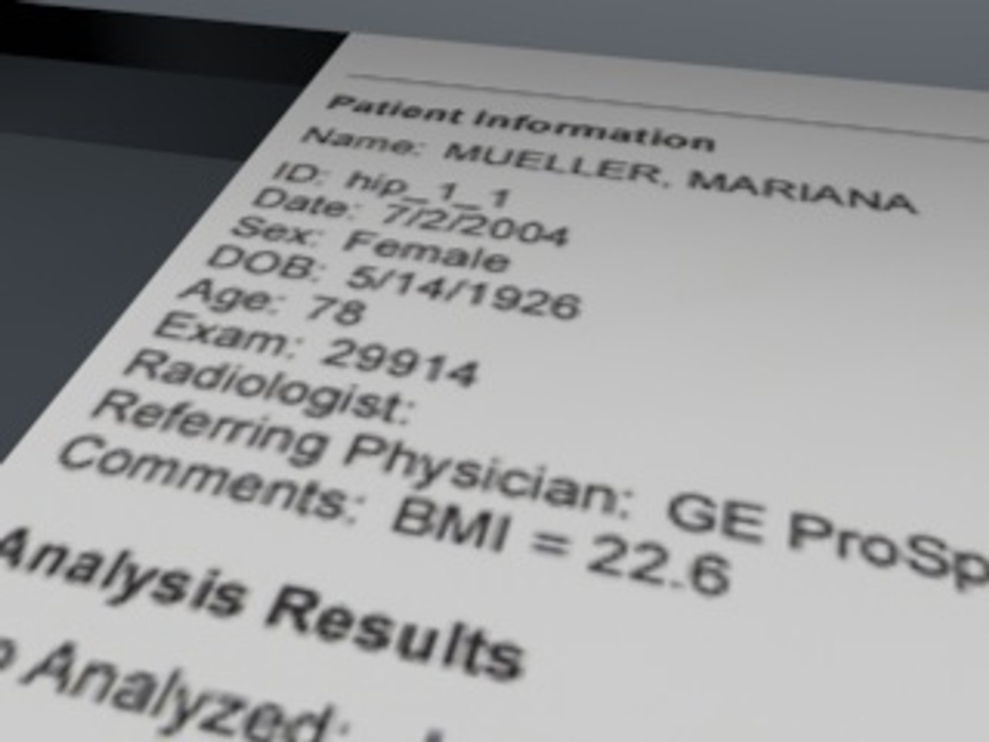 3dsmax hologic bone densitometer https://p.turbosquid.com/ts-thumb/Kf/oZG0jH/CSumPyQ6/screenshot9/jpg/1300450977/1920x1080/fit_q87/e13e7ae92e3187a4018d6f7cc70acf1c9f8b7c9b/screenshot9.jpg