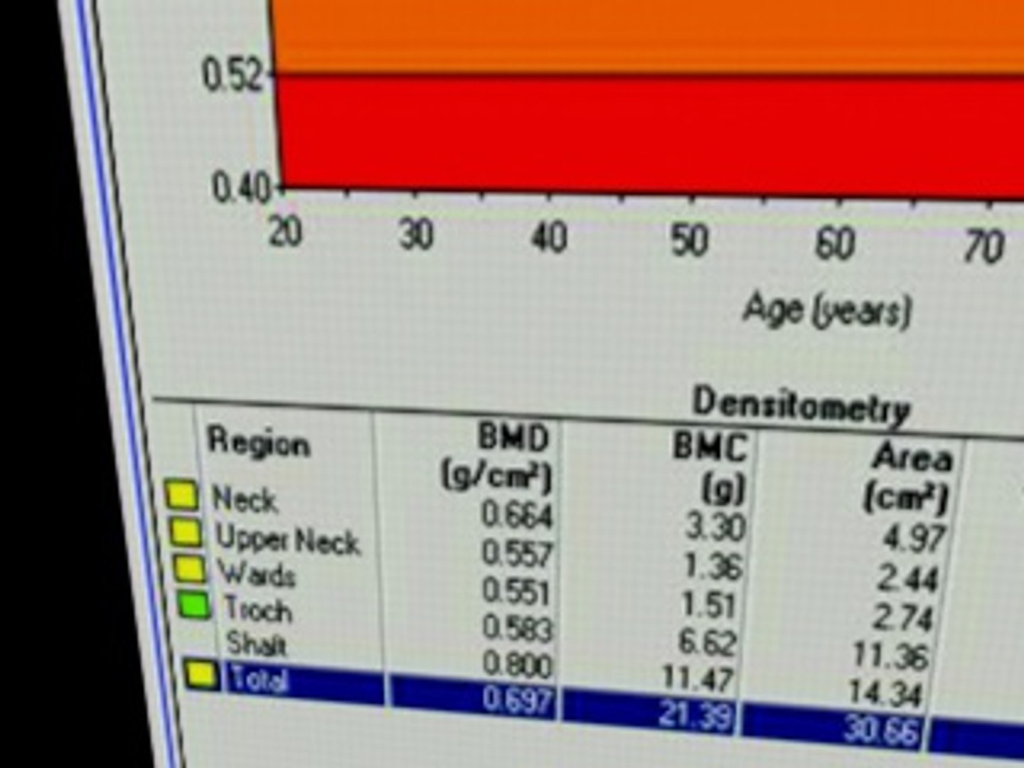3dsmax hologic bone densitometer https://p.turbosquid.com/ts-thumb/Kf/oZG0jH/Dx36czvW/screenshot16/jpg/1300450977/1920x1080/fit_q87/e3e8fc5812a15596fbcdd90972f1051469b2902c/screenshot16.jpg