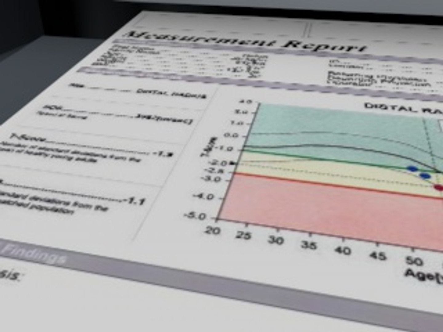 3dsmax hologic bone densitometer https://p.turbosquid.com/ts-thumb/Kf/oZG0jH/NbjkUTCu/screenshot10/jpg/1300450977/1920x1080/fit_q87/3b64023f35e9335dd98dd37ad4cfe675f0ae476f/screenshot10.jpg