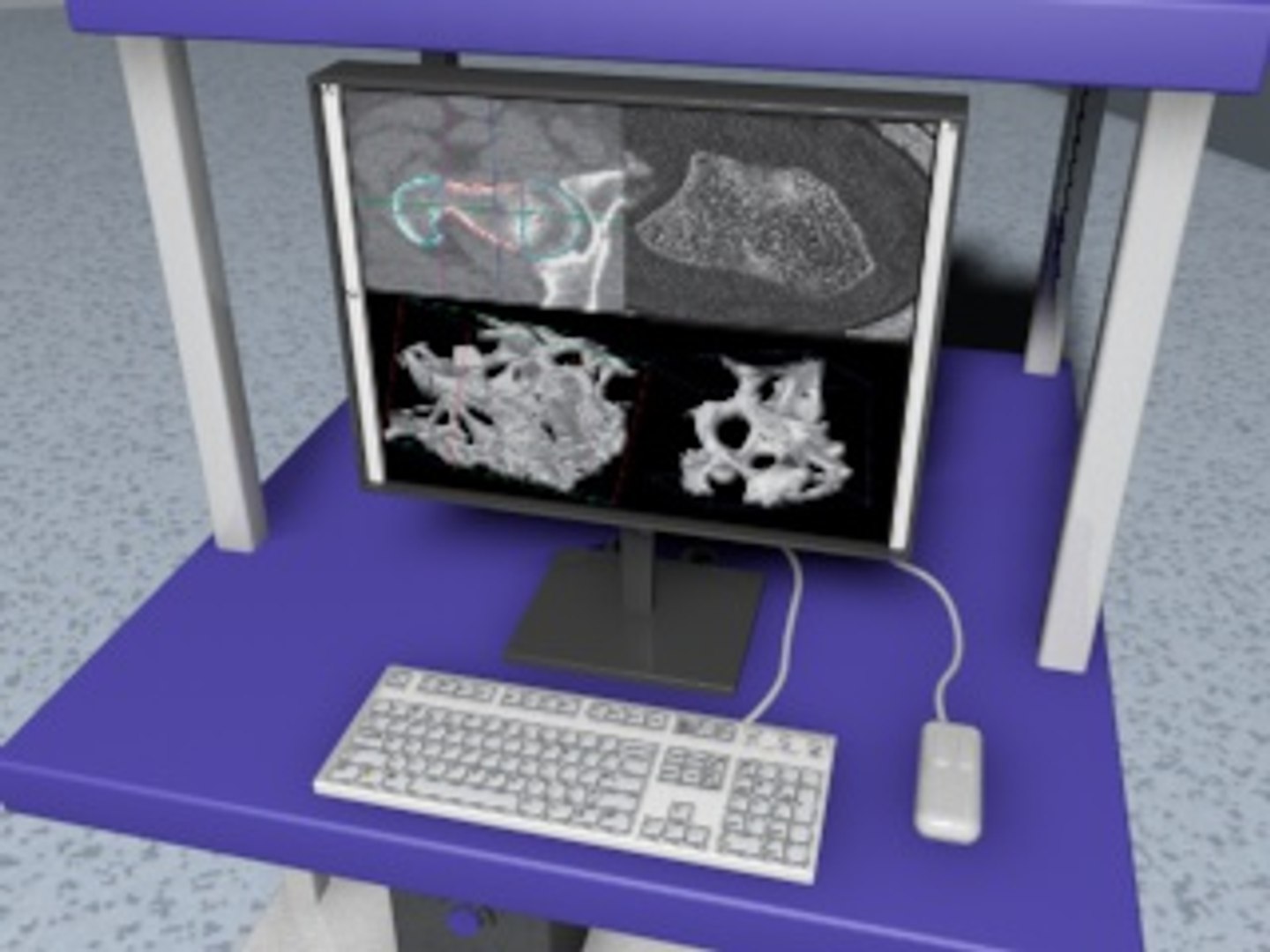 3dsmax hologic bone densitometer https://p.turbosquid.com/ts-thumb/Kf/oZG0jH/P5KA1PaE/screenshot13/jpg/1300450977/1920x1080/fit_q87/24d6ce2aa114b6e330203ee790deab5bdf689011/screenshot13.jpg