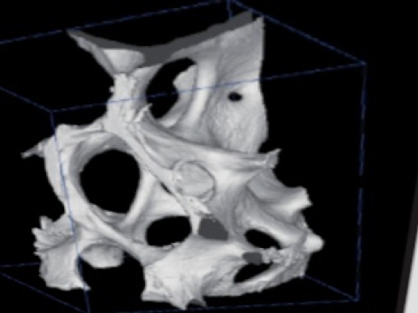 3dsmax hologic bone densitometer https://p.turbosquid.com/ts-thumb/Kf/oZG0jH/iC6AmyuE/screenshot17/jpg/1300450977/1920x1080/fit_q87/37b562f40c61126525e8f0d8856bc23d63725ded/screenshot17.jpg