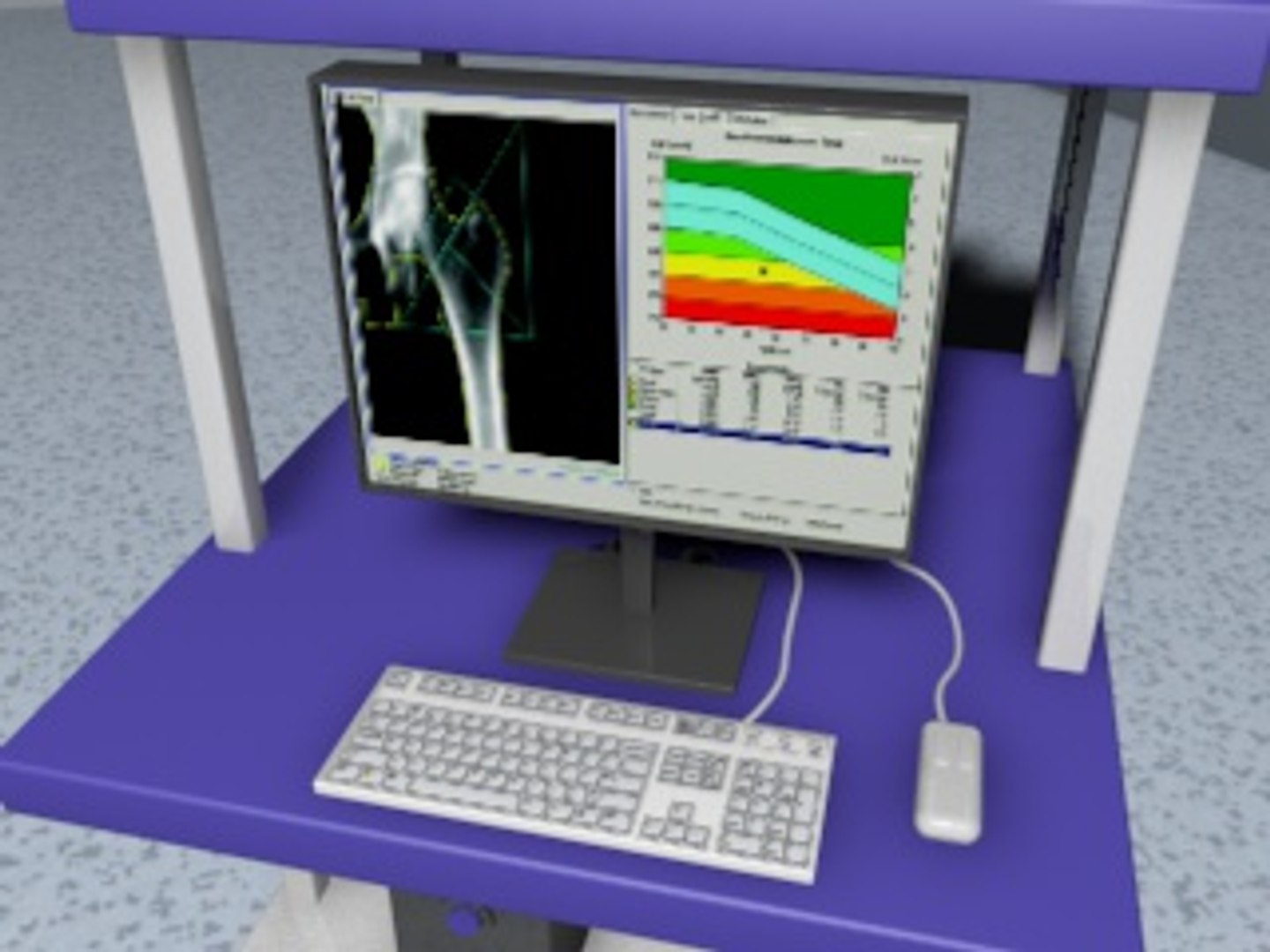 3dsmax hologic bone densitometer https://p.turbosquid.com/ts-thumb/Kf/oZG0jH/qC0VQo55/screenshot15/jpg/1300450977/1920x1080/fit_q87/34a5ae71d5f586734bfd8c7957db4320c7177883/screenshot15.jpg