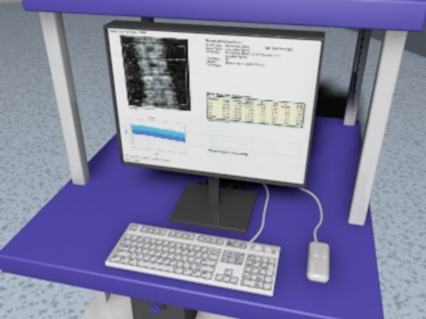 3dsmax hologic bone densitometer https://p.turbosquid.com/ts-thumb/Kf/oZG0jH/uGTKcsiu/screenshot14/jpg/1300450977/1920x1080/fit_q87/bb77f6c169c94df29f23511e598b45ac382929e5/screenshot14.jpg