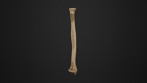 Human Anatomy-Radius Bone