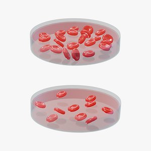 Normal Blood Cells vs Anemia