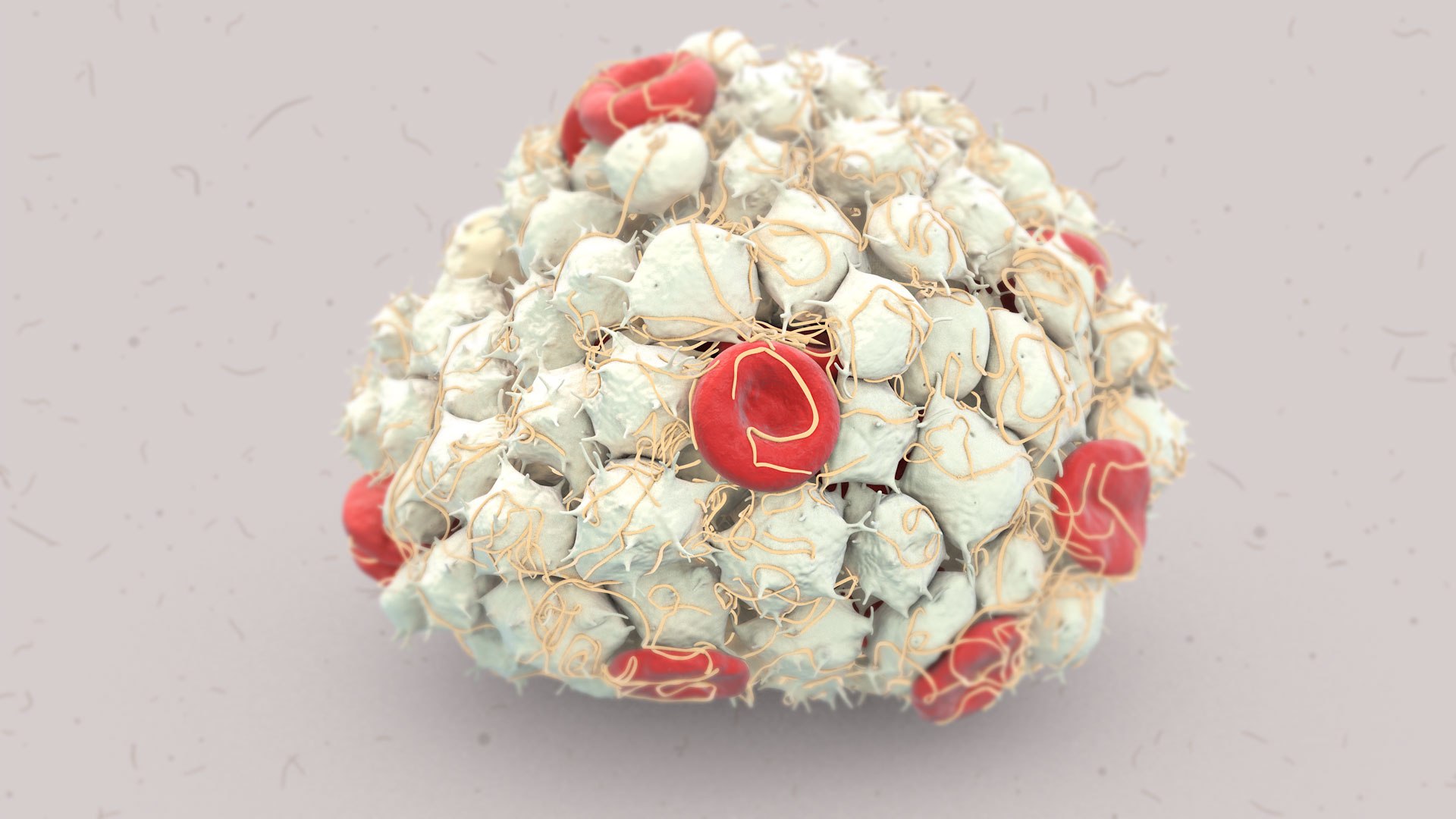 Arterial Thrombus 3D model https://p.turbosquid.com/ts-thumb/LC/am46XE/qd/art_clot_color00001/jpg/1767541626/1920x1080/fit_q87/0628f84c423bfb3510f8b98ba4d83e5efad531f8/art_clot_color00001.jpg