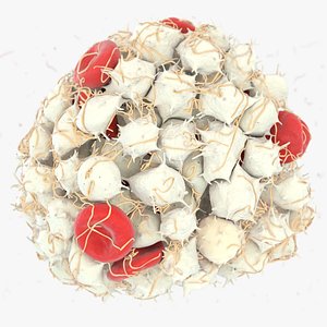 Arterial Thrombus 3D model