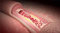 vascular blood pressure macro system rigged bonus animated scene(dirty scene)