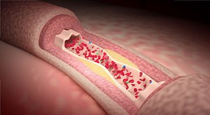 vascular blood pressure macro system rigged bonus animated scene(dirty scene)
