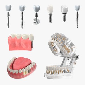 3D Tooth Implants Collection 3 model
