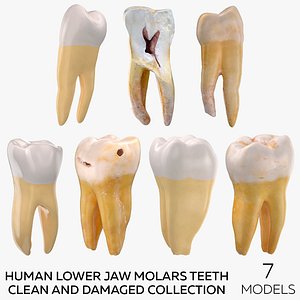 Human Lower Jaw Molars Teeth Clean and Damaged Collection - 7 models model