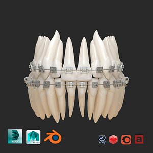 teeth 3D
