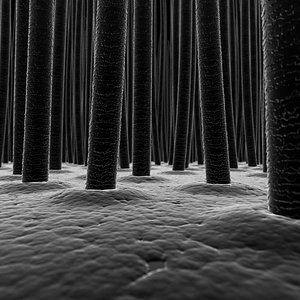 Scalp and Hair Closeup X-Ray