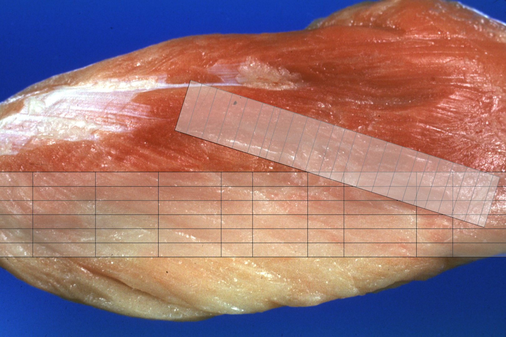 types skin squamous 3D https://p.turbosquid.com/ts-thumb/LR/XYodDw/QDKVuEOn/uv1/png/1537113320/1920x1080/fit_q87/088ac4ca66cd6614eb2a24e0186231747676e38f/uv1.jpg