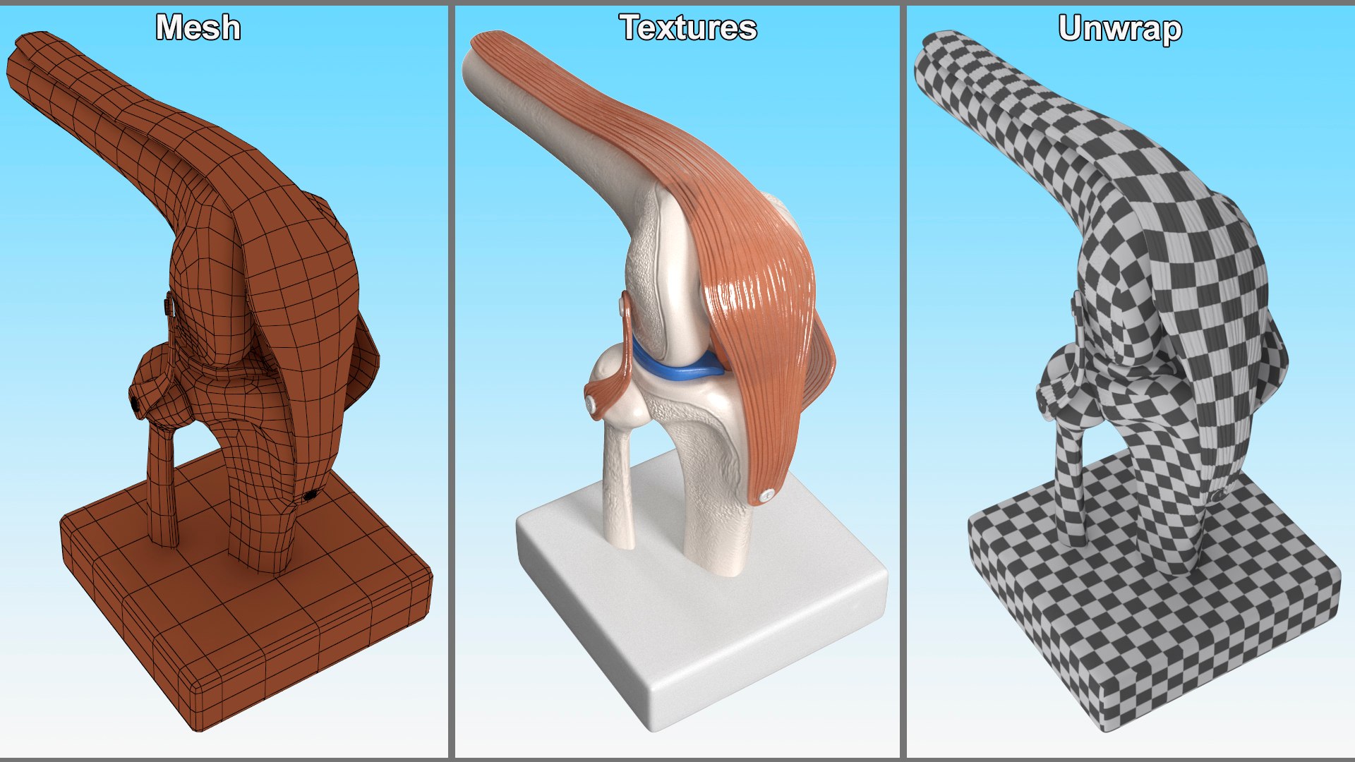 3D Knee Joint Model in Flexed Position https://p.turbosquid.com/ts-thumb/LV/6w3Wbi/Lg/kneejointmodelinflexedpositionvray3dmodel011/jpg/1726018758/1920x1080/fit_q87/ecd39f355c5d8c366f041974d48d9b35f9b373e9/kneejointmodelinflexedpositionvray3dmodel011.jpg