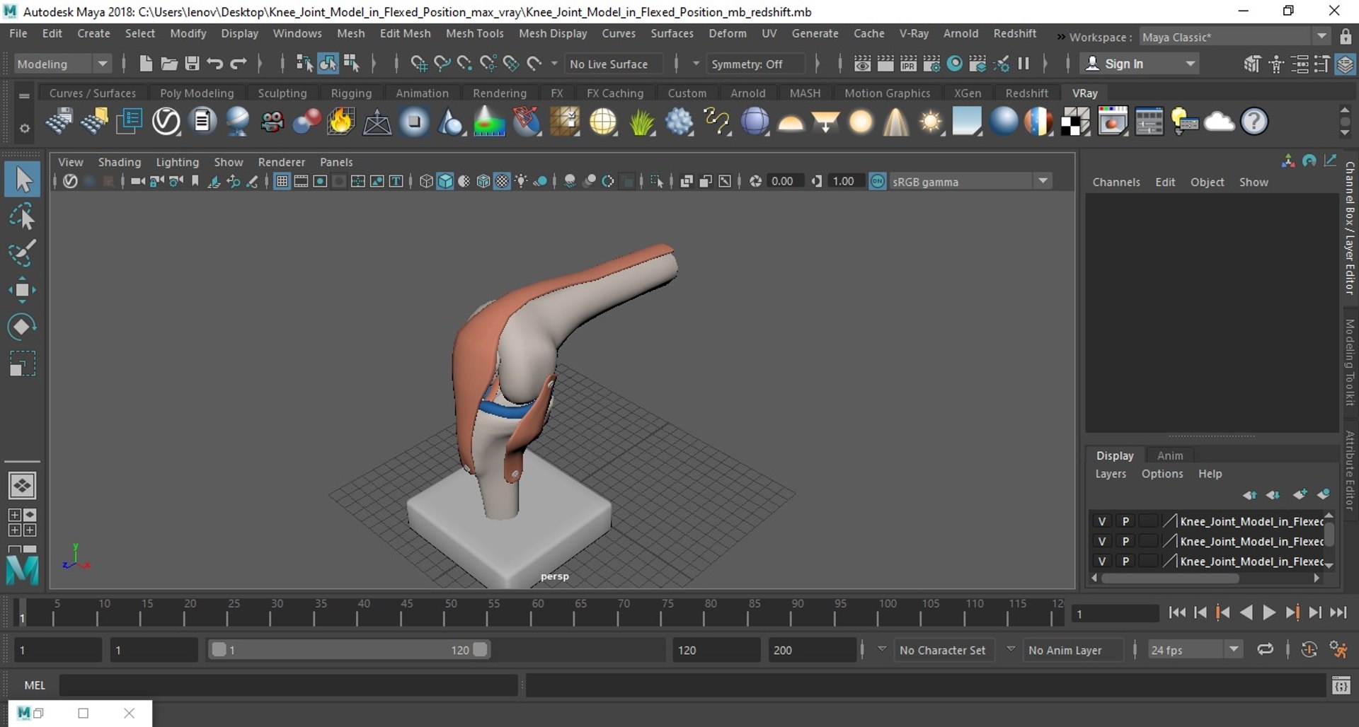 3D Knee Joint Model in Flexed Position https://p.turbosquid.com/ts-thumb/LV/6w3Wbi/lX/kneejointmodelinflexedpositionvray3dmodel024/jpg/1726018811/1920x1080/fit_q87/47b1cdae9dfcad33d9b6c383a1207002d58693bd/kneejointmodelinflexedpositionvray3dmodel024.jpg