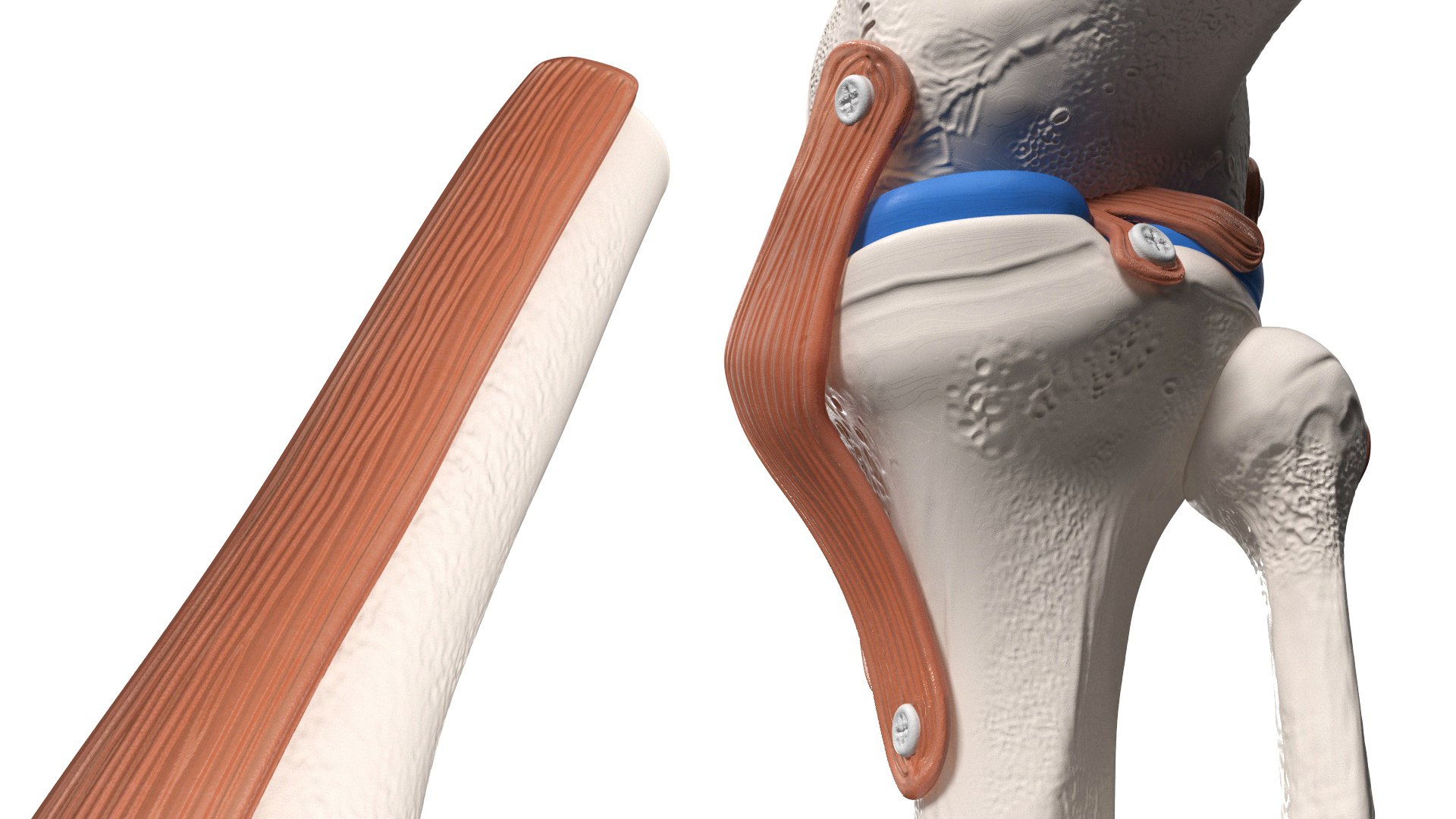 3D Knee Joint Model in Flexed Position https://p.turbosquid.com/ts-thumb/LV/6w3Wbi/pj/kneejointmodelinflexedpositionvray3dmodel009/jpg/1726018743/1920x1080/fit_q87/86cab24ce8961e7936c2ebb5e666a135970766fc/kneejointmodelinflexedpositionvray3dmodel009.jpg