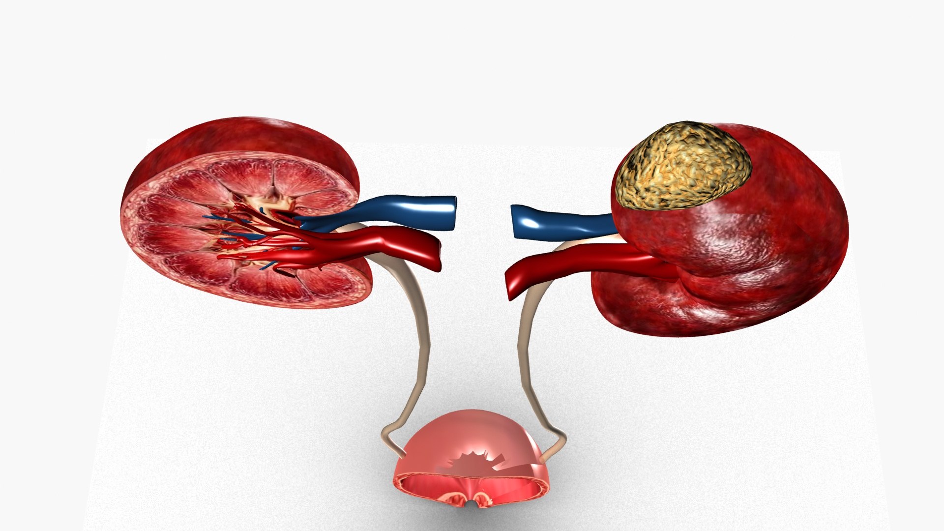 Kidneys 3D model https://p.turbosquid.com/ts-thumb/LY/CsdrNo/1B/ps6/jpg/1780225508/1920x1080/fit_q87/c141392176c815200b43d98fc198c0f858d719fd/ps6.jpg