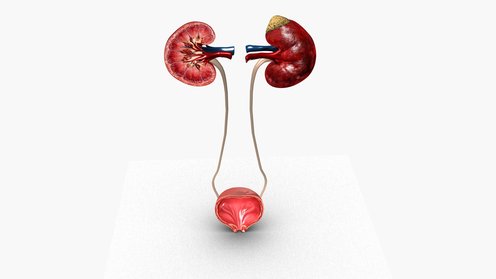 Kidneys 3D model https://p.turbosquid.com/ts-thumb/LY/CsdrNo/4P/kid/jpg/1780225549/1920x1080/turn_fit_q99/aa3745b3ba5491f415baa3af17a3a434fefe0add/kid-1.jpg