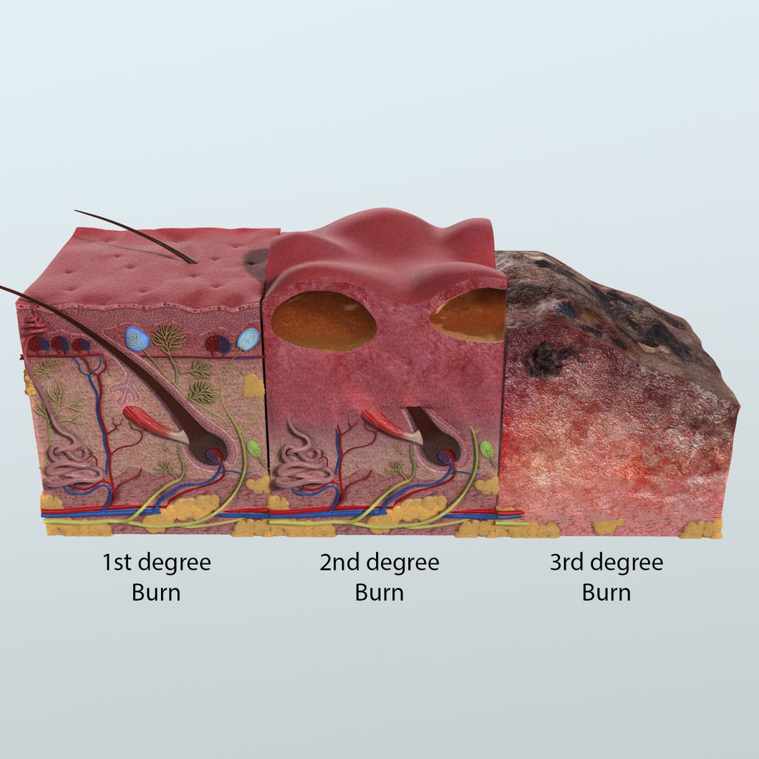 3D Model Realistic Skin Anatomy - TurboSquid 1164416