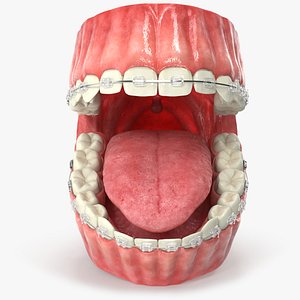 Human Mouth With Transparent Dental Braces V04 3D model