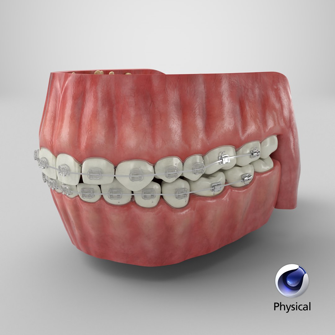 Human Mouth With Transparent Dental Braces V04 3D model https://p.turbosquid.com/ts-thumb/Lo/ypf9UY/LH/stemcell_cinema_4d_physical_render/png/1712696963/1920x1080/fit_q87/dd851276551243264456d30f439de0487ae11692/stemcell_cinema_4d_physical_render.jpg