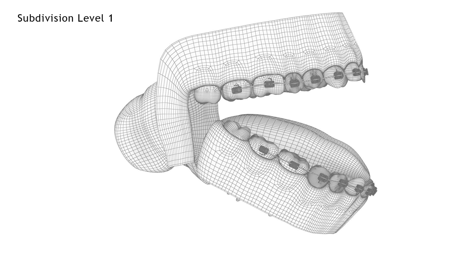 Human Mouth With Transparent Dental Braces V04 3D model https://p.turbosquid.com/ts-thumb/Lo/ypf9UY/UZ/mouth_self_ligating_steel_dental_braces_wire2.1/jpg/1711971856/1920x1080/fit_q87/b14d67903278adf8f5b2ad5c9602d07edfcb53f3/mouth_self_ligating_steel_dental_braces_wire2.1.jpg